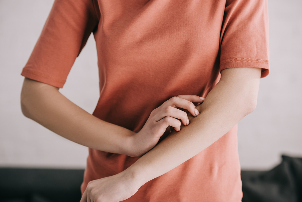 Como evitar alergia com roupas? 3 coceira alergia